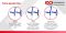 Підлокітна милиця для дітей Kiddy Line Ossenberg 242 DSK combi (242-00-02-90-90-02-113)