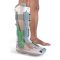 Ортопедичний ортез для іммобілізації XP Diabetic Walker System DJO Global 01PD-1172